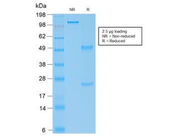 Recombinant IgG4 Antibody