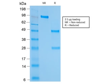 Recombinant HSP60 Antibody / HSPD1