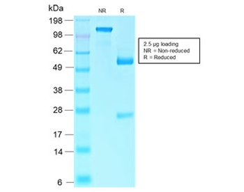 Recombinant RB1 Antibody / Rabbit Monoclonal