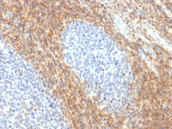 Recombinant CD52 Antibody