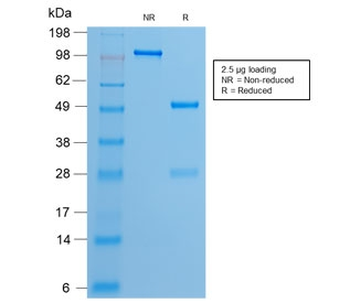 Recombinant Estrogen Receptor Antibody (alpha)