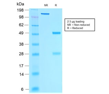 Recombinant Estrogen Receptor alpha Antibody