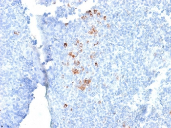 Recombinant Human IgG Antibody