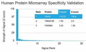 Recombinant Human IgG Antibody