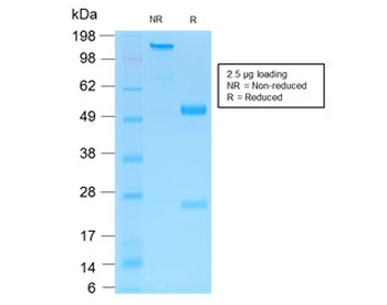 Recombinant p75NTR Antibody / NGFR
