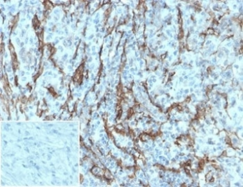 Recombinant p75NTR Antibody / NGFR