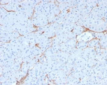 Recombinant p75NTR Antibody / NGFR