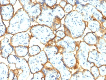 Recombinant Insulin Receptor alpha Antibody