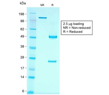 Recombinant Cadherin 16 Antibody