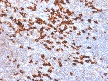Recombinant Kappa Antibody / Rabbit Monoclonal