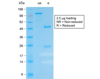 Recombinant Kappa Antibody / Rabbit Monoclonal