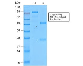 Recombinant Involucrin Antibody