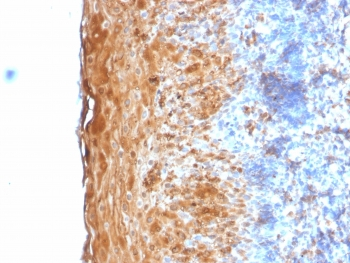 Recombinant Involucrin Antibody