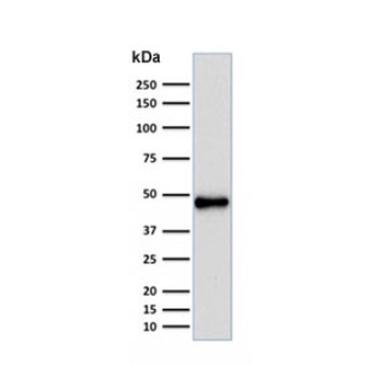 Recombinant PAX5 Antibody
