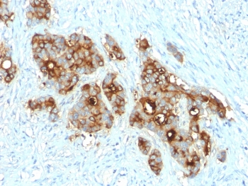 Recombinant CD66 Antibody / CEA / CEACAM5