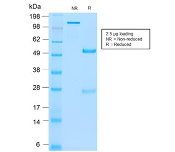Recombinant CD66 Antibody / CEA / CEACAM5