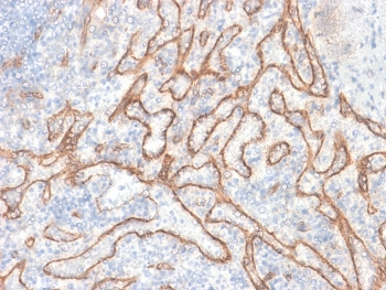 Recombinant b-Catenin Antibody