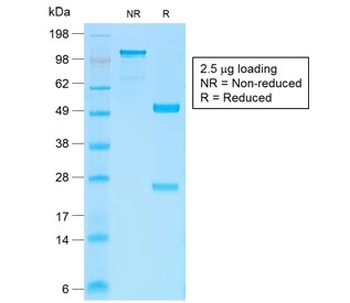Recombinant b-Catenin Antibody
