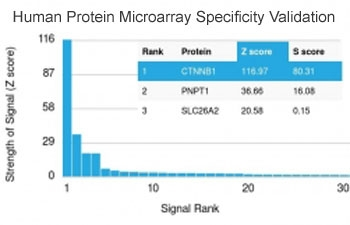 Recombinant Beta Catenin Antibody
