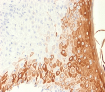 Recombinant Keratin 10 Antibody