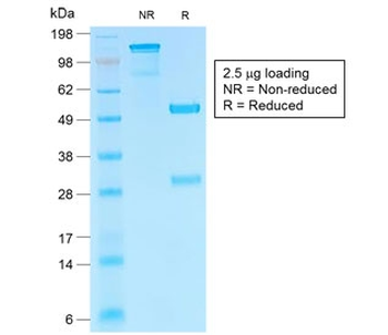 Recombinant HCG-beta Antibody / Rabbit Monoclonal