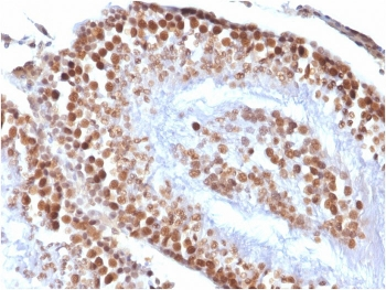 Recombinant WT1 Antibody / Wilm's Tumor