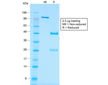 Recombinant WT1 Antibody / Wilm's Tumor