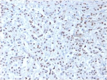 Recombinant WT1 Antibody / Wilm's Tumor