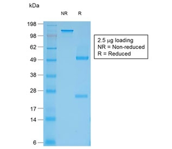 Recombinant Filaggrin Antibody
