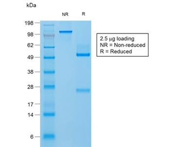 Recombinant FLG Antibody / Filaggrin