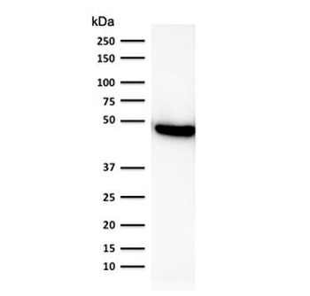 Recombinant CK19 Antibody / Cytokeratin 19