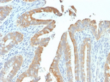 Recombinant Cytokeratin 19 Antibody