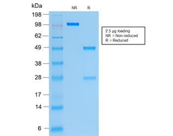 Recombinant Cytokeratin 19 Antibody