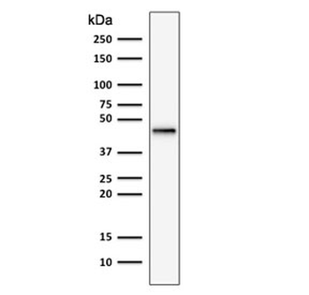 Recombinant Cytokeratin 19 Antibody