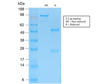 Recombinant Cytokeratin 15 Antibody / Rabbit Monoclonal