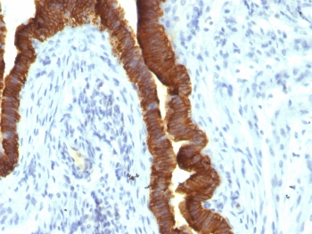 Recombinant EpCAM Antibody / Cytoplasmic domain