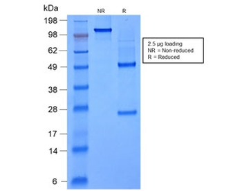 Recombinant FOXA1 Antibody