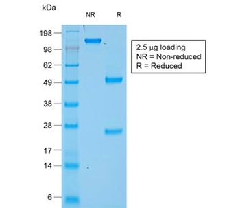 Recombinant CHGA Antibody / Chromogranin A
