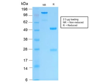 Recombinant Keratin 16 Antibody / Rabbit Monoclonal