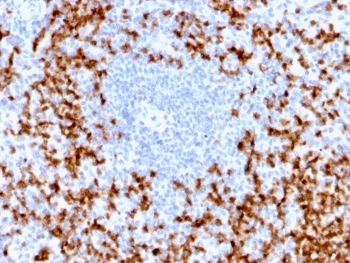 Recombinant MMP9 Antibody / Rabbit Monoclonal