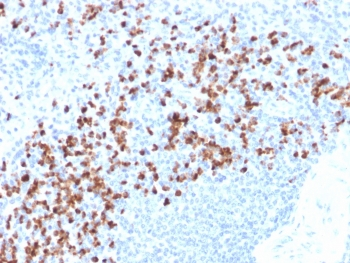 Recombinant MMP9 Antibody