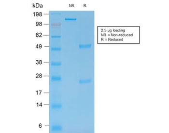 Recombinant MMP9 Antibody