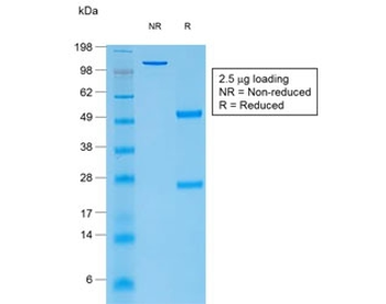 Recombinant TG Antibody / Thyroglobulin