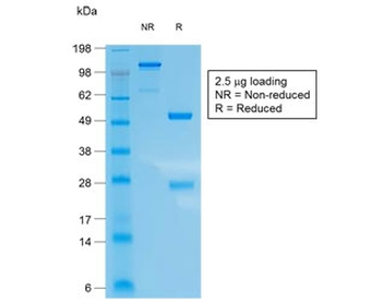 Recombinant CK10 Antibody / Rabbit Monoclonal