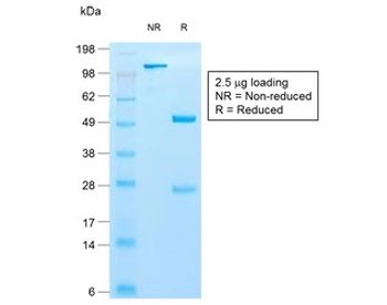 Recombinant Cytokeratin 10 Antibody / Rabbit Monoclonal