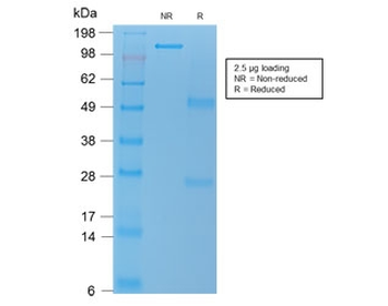Recombinant TL1A Antibody / TNFSF15 / VEGI
