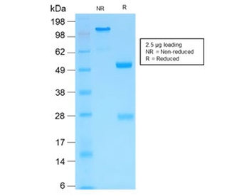 Recombinant MMP3 Antibody / Rabbit Monoclonal