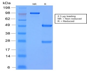 Recombinant MMP3 Antibody