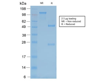 Recombinant Neurofilament Antibody / Heavy