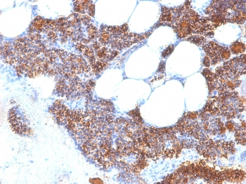 Recombinant PTH Antibody (N-Terminal) / Rabbit Monoclonal